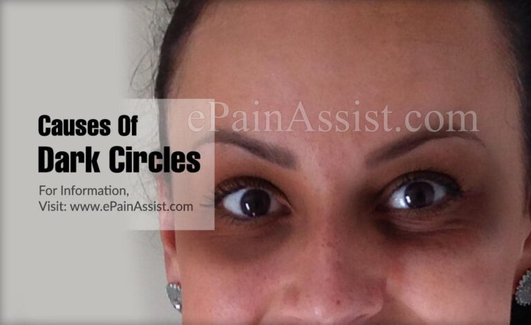 Can lack of iron cause dark circles?