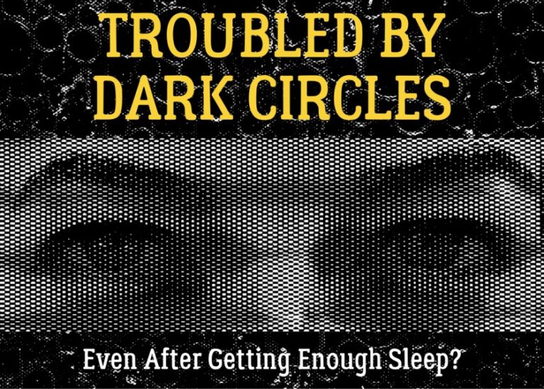 Why do I have dark circles even when I get enough sleep?