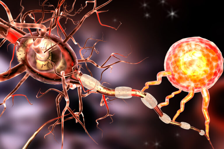 Can MS nerve damage be repaired?